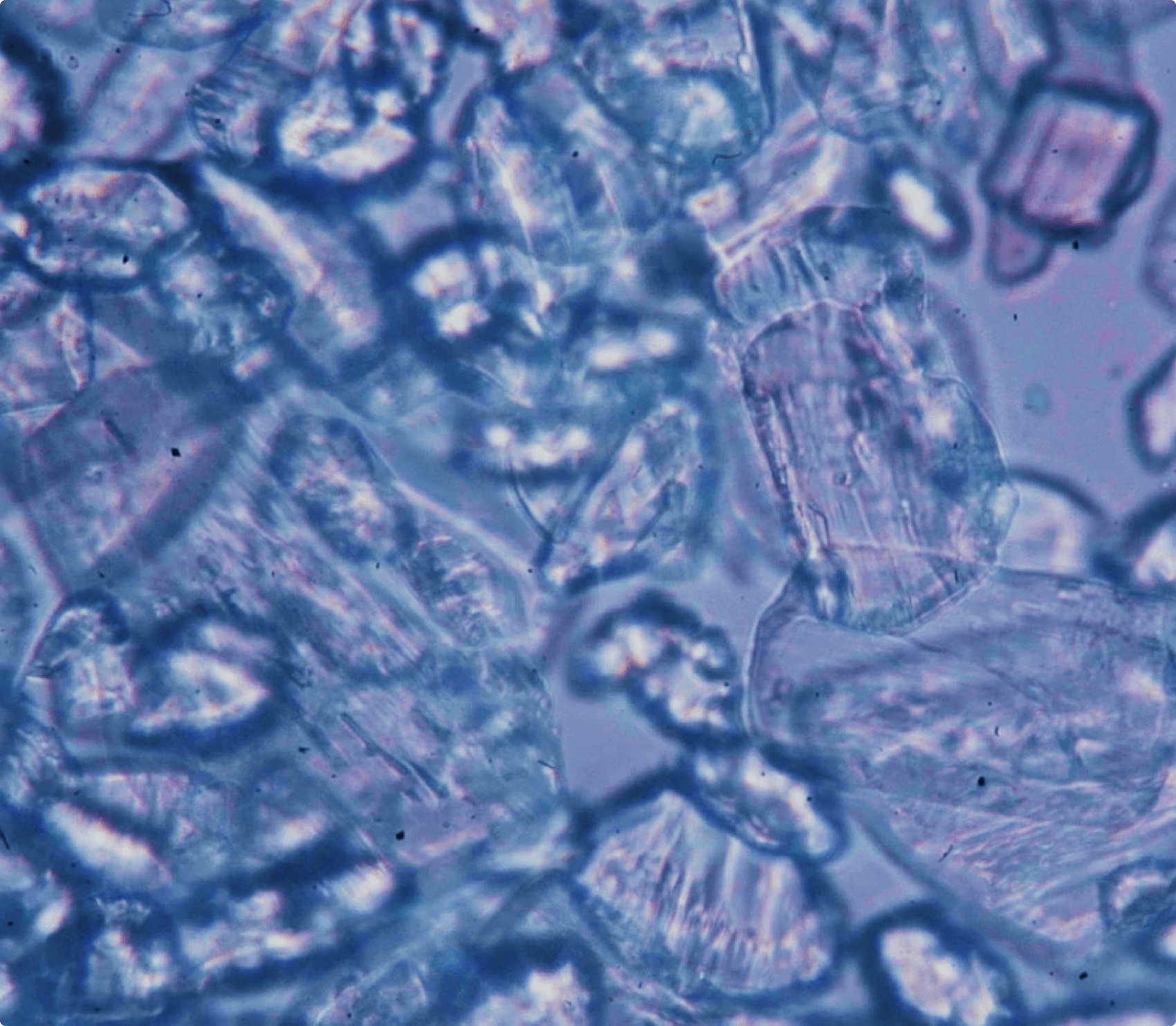 Mold & Mycotoxins